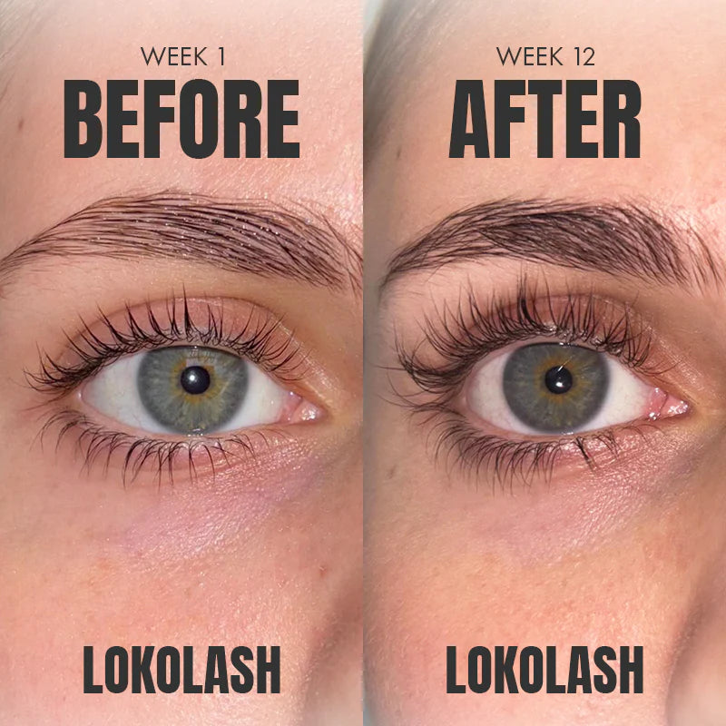Lokolash Serum Pro Eyelash Serum