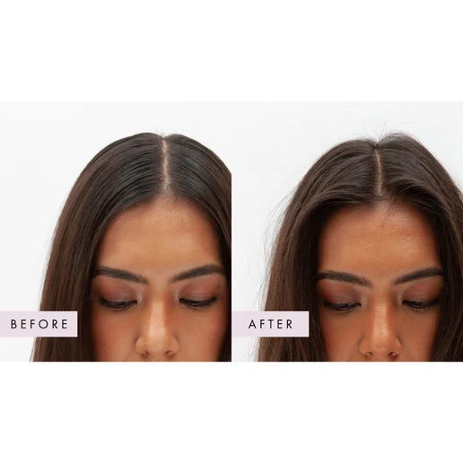 Hair Gain Peptide Puff™ Dry Shampoo